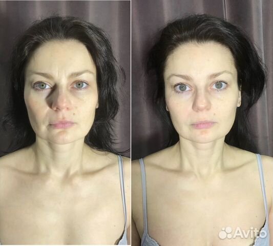 Массаж лица и головы миофасциальный