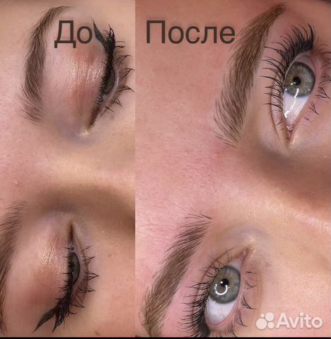 Микроблейдинг 6 Д