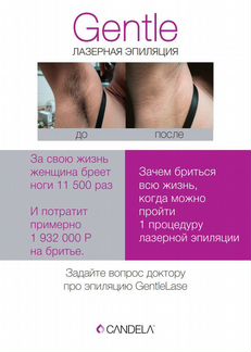 Лазерная эпиляция