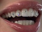 Скайсы кристаллы на зубы